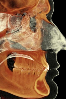 i-CAT&reg; 3D Imaging